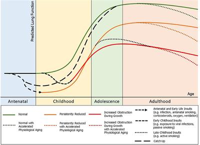 Predicting Lung Health Trajectories for Survivors of Preterm Birth